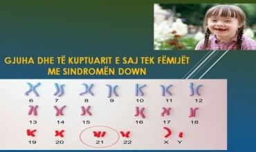 Gjuha dhe të kuptuarit e saj tek fëmijët me sindromën Down   