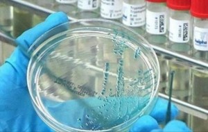 Shkencëtarët: Të ndalohet përdorimi i dy kimikateve antimikrobike